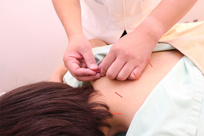 初めての方にもおすすめ 目白駅近くの口コミで評判の鍼灸院4選 マチしる東京