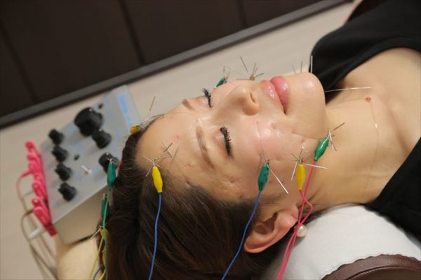 銀座 有楽町でおすすめの美容鍼 フェイシャルエステ おすすめ7選 マチしる東京